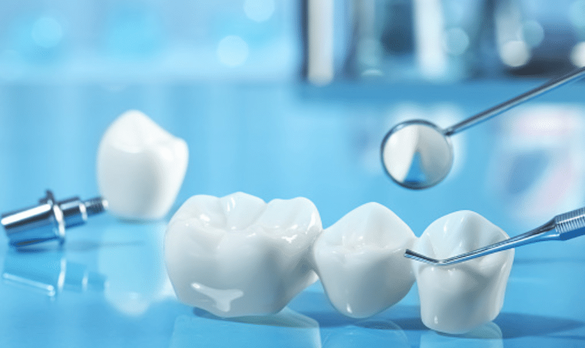 dental crowns Garland TX