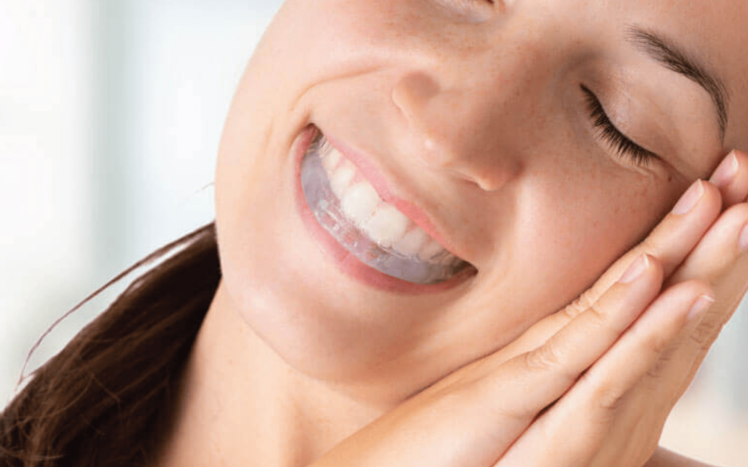 What Are The Benefits Of Wearing A Night Guard & Why Do Dentists Recommend Them?
