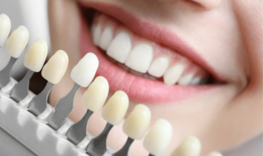 Identifying the Right Dental Crown: A Summary of Your Options