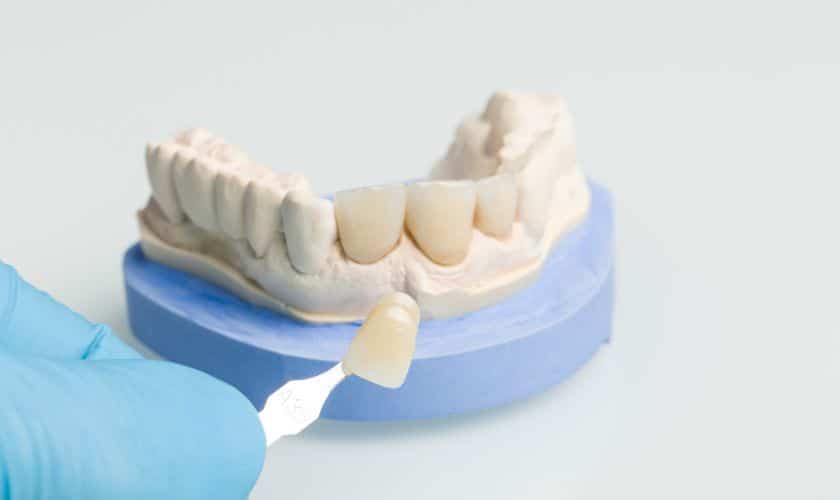 restorative dentist Campbell Crossing Dentistry