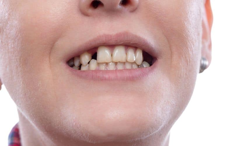 restorative dentistry
