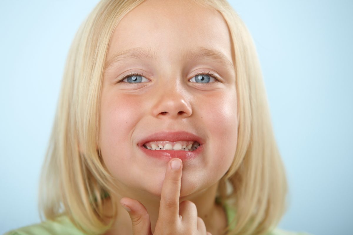 Young girl pointing at a damaged tooth, highlighting the effects of sugar on dental health and enamel.